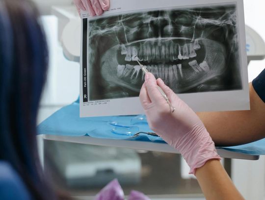 Pantomogram: Klucz do Diagnostyki Stomatologicznej